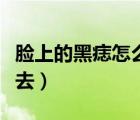 臉上的黑痣怎么去掉多少錢（臉上的黑痣怎么去）