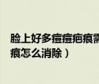 臉上好多痘痘疤痕需要怎么樣才能去掉（臉上好多痘印和疤痕怎么消除）