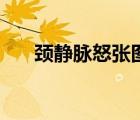 頸靜脈怒張圖片（頸靜脈怒張?jiān)趺粗危?/>
                                    </a>
                                                </div>
                                    <div   id=
