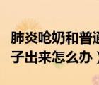 肺炎嗆奶和普通嗆奶的區(qū)別（新生兒嗆奶從鼻子出來怎么辦）