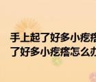 手上起了好多小疙瘩有的還有點癢還脫皮抹什么藥（手上起了好多小疙瘩怎么辦）