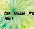 皮膚一撓就起一片疙瘩怎么辦（皮膚一撓就起一片疙瘩如何消除）