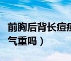 前胸后背長痘痘是濕氣重嗎（后背長痘痘是濕氣重嗎）