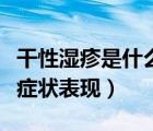 干性濕疹是什么樣的癥狀（干性濕疹會有哪些癥狀表現(xiàn)）