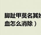 腳趾甲莫名其妙黑了一塊不疼（指甲里面有淤血怎么消除）