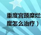 重度宮頸糜爛怎么引起的（19歲宮頸糜爛重度怎么治療）