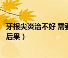 牙根尖炎治不好 需要拔牙齒嗎（牙根尖炎不治療會(huì)造成什么后果）