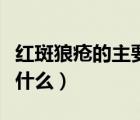 紅斑狼瘡的主要癥狀（紅斑狼瘡的死亡征兆是什么）