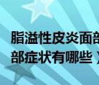 脂溢性皮炎面部的癥狀有哪些（脂溢性皮炎面部癥狀有哪些）