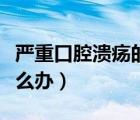 嚴(yán)重口腔潰瘍的治療方法（嚴(yán)重的口腔潰瘍?cè)趺崔k）