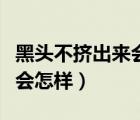 黑頭不擠出來會造成皮膚什么問題（黑頭不擠會怎樣）