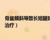 骨盆傾斜導(dǎo)致長(zhǎng)短腿如何治療好（骨盆傾斜導(dǎo)致長(zhǎng)短腿如何治療）