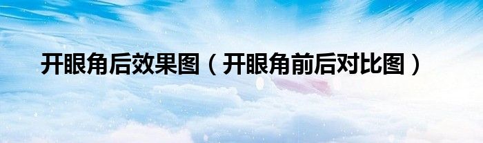 開眼角后效果圖（開眼角前后對比圖）