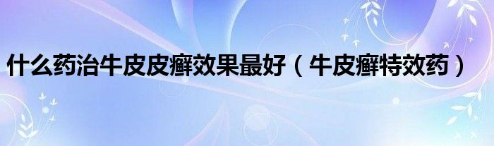 什么藥治牛皮皮癬效果最好（牛皮癬特效藥）